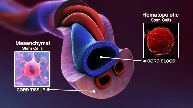 stem cell therapy, regenerative medicine, healing with stem cells, stem cell treatment, stem cell benefits, stem cell services, Stemcell Therapeutics, medical stem cell, advanced stem cell care, stem cell recovery, stem cell research, stem cell healing, stem cell clinic